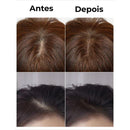 Aura Hairline – Sua beleza merece mais do que retoques